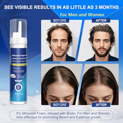 AOOLCF minoxidil foam shows a three-month supply for consistent use