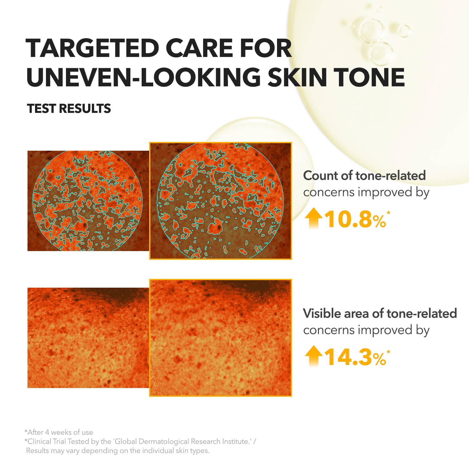 APRILSKIN A.C.E Serum neck decolletage application suggesting even-toned glow.