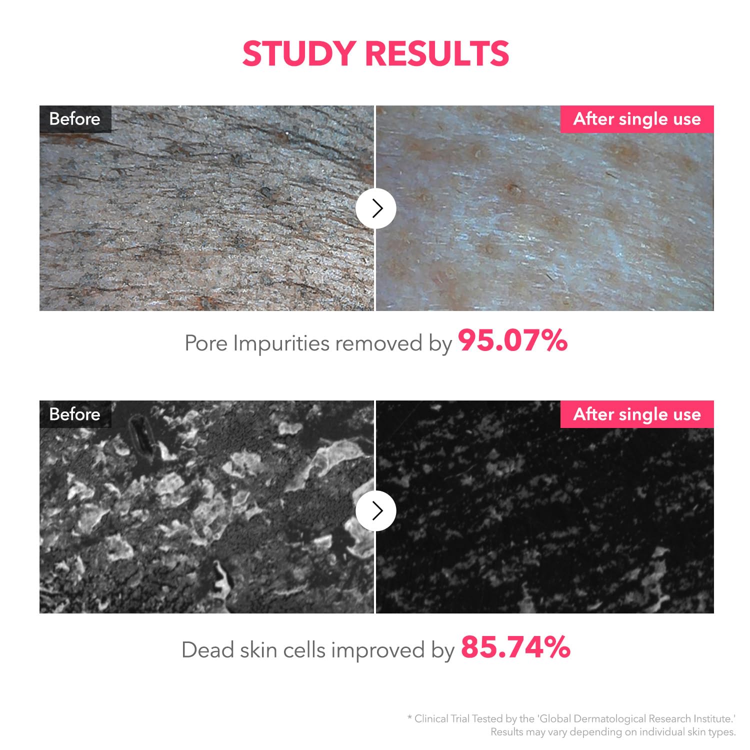 APRILSKIN pore-refinement scene with smoother skin appearance.