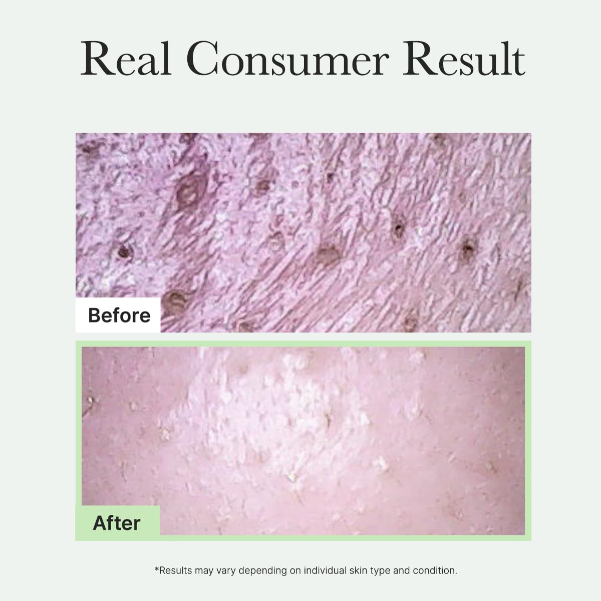 ARENCIA Hypoallergenic test seal supports safe use for sensitive skin.