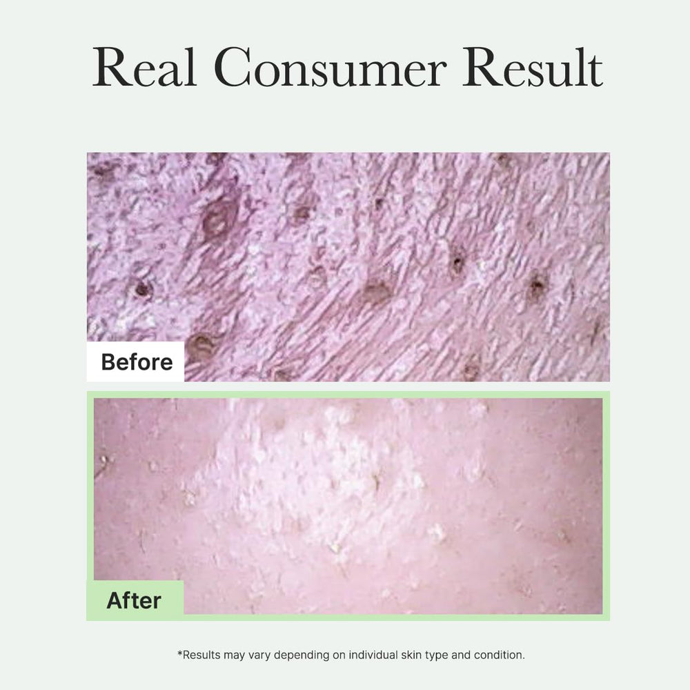 ARENCIA Hypoallergenic test seal supports safe use for sensitive skin.