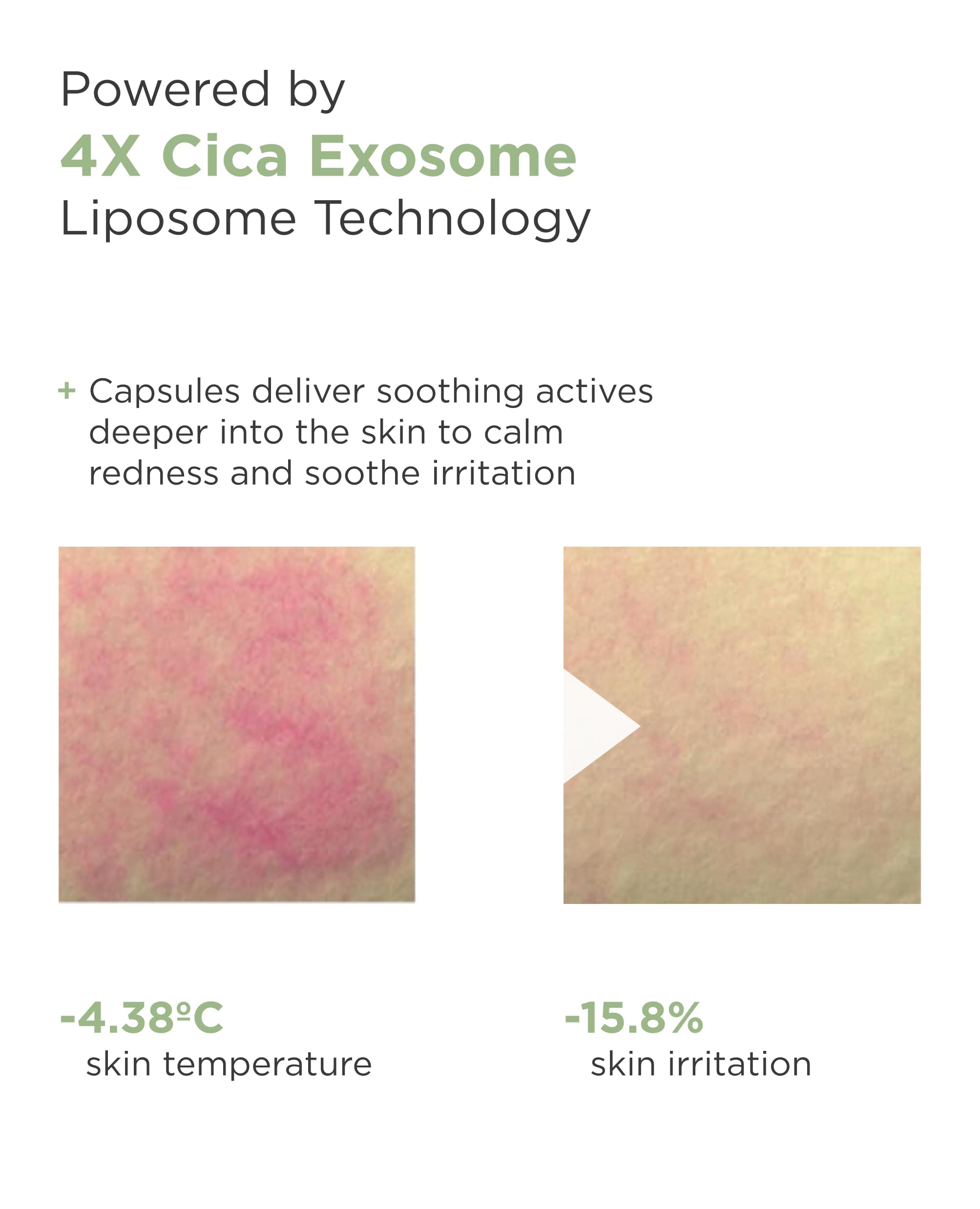 AROCELL Cica Hydrogel Mask dermatologist-tested for safe daily use.
