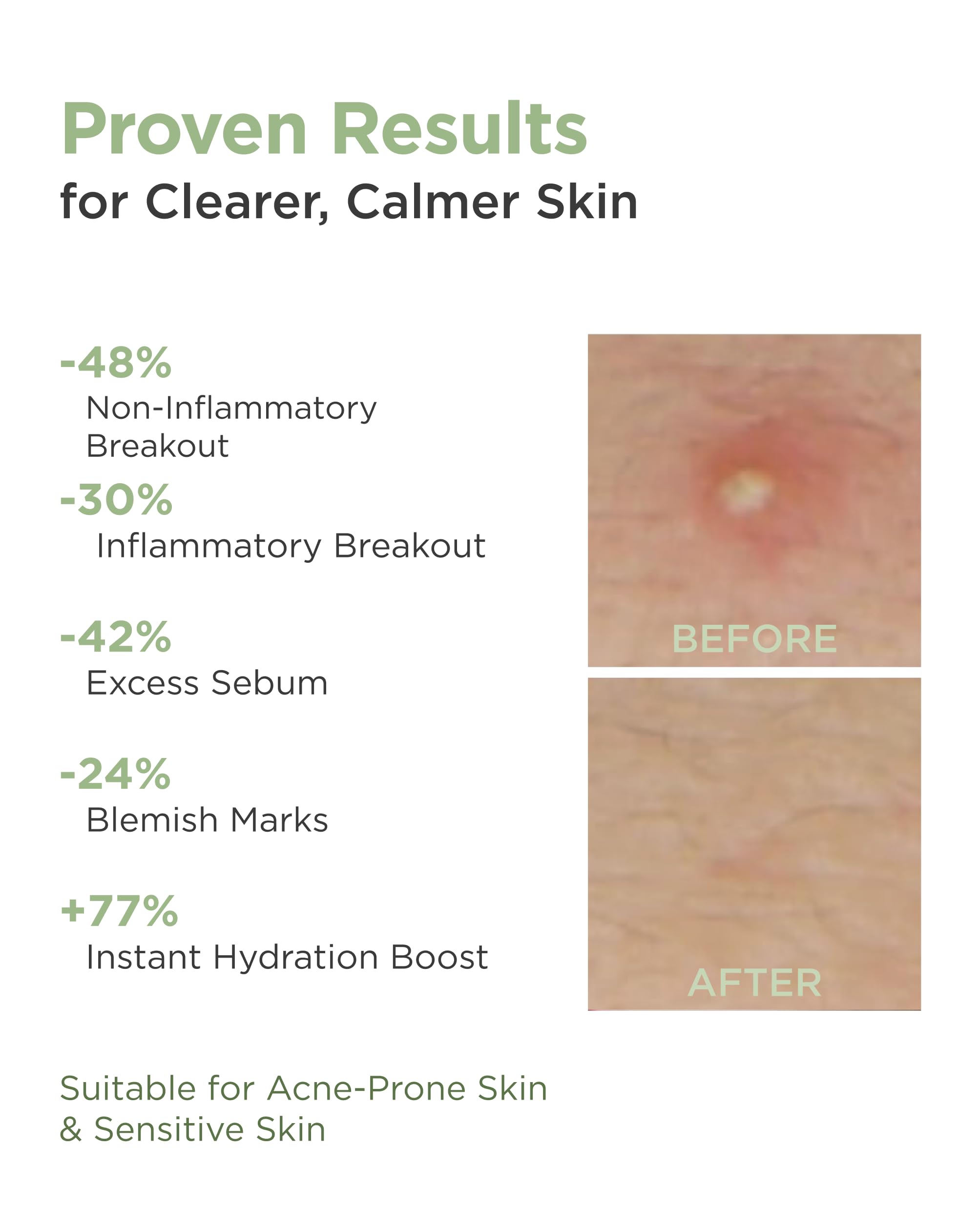 AROCELL Cica Hydrogel Mask micro-airhole technology enhances absorption.
