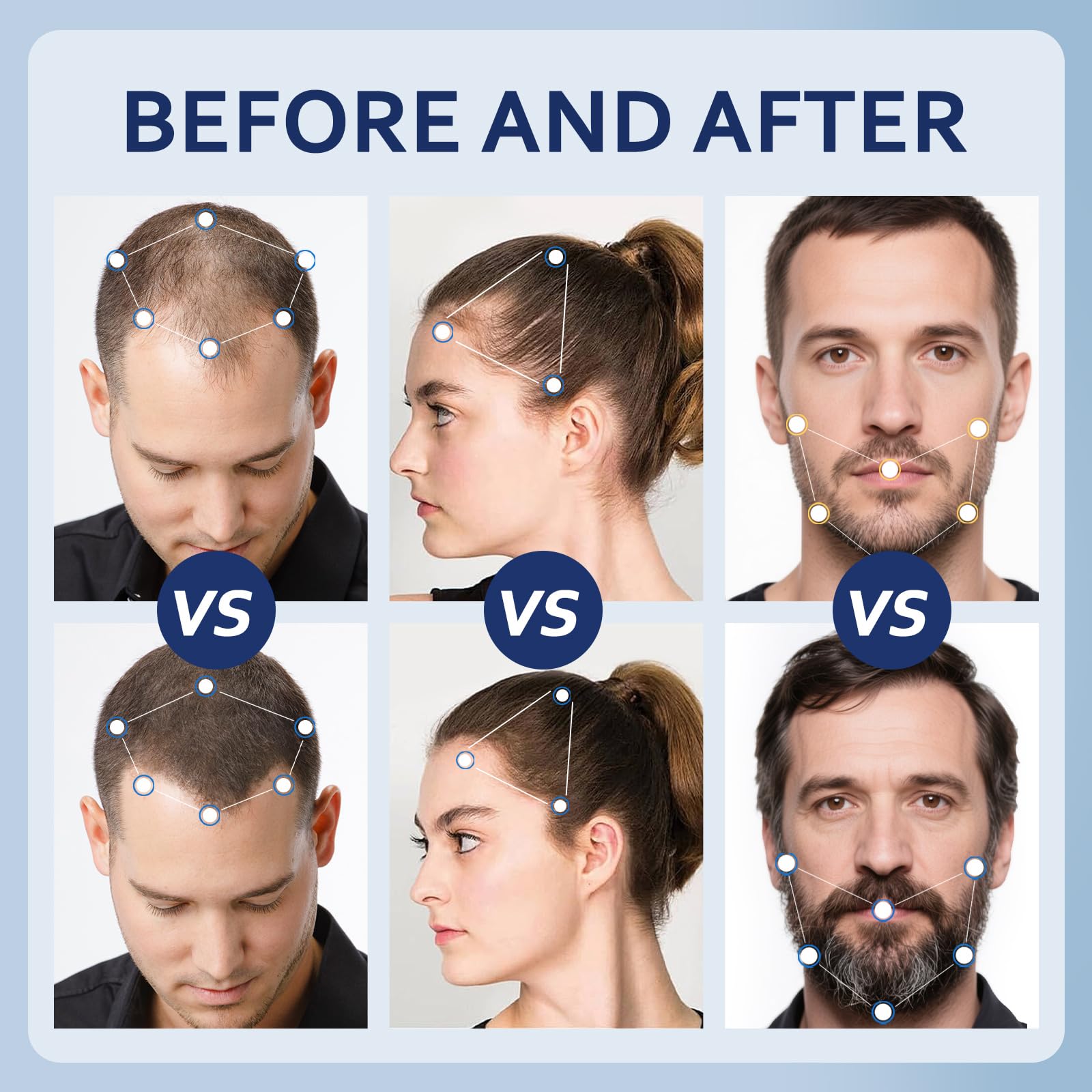 Artimore Minoxidil shows absorption with no residue on scalp