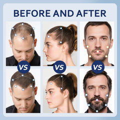 Artimore Minoxidil shows absorption with no residue on scalp