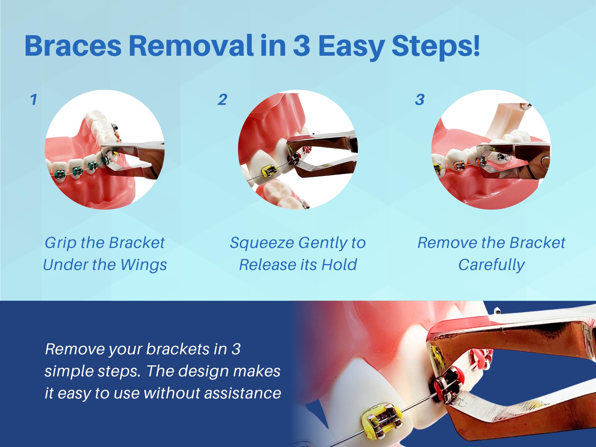 ARTMAN autoclavable braces remover demonstrated for repeated professional use.