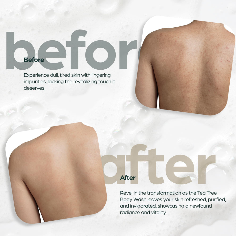 Close-up of eczema-focused ingredients on Artnaturals label.