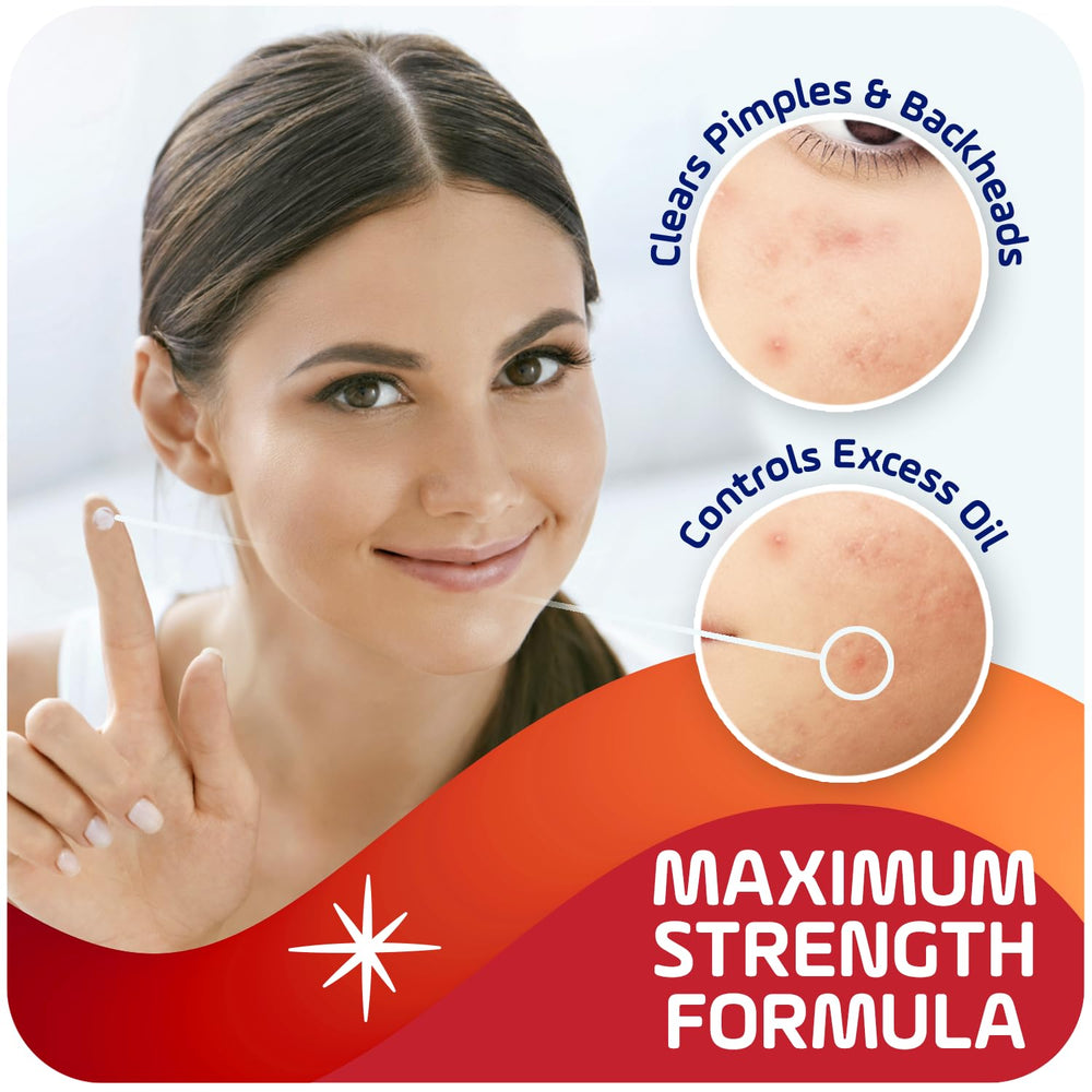 Asepxia 1 oz tube packaging visible for travel-ready acne care