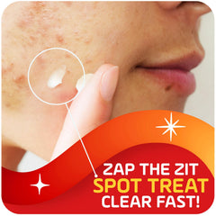 Asepxia spot-treatment dabbed on a pimple for targeted action