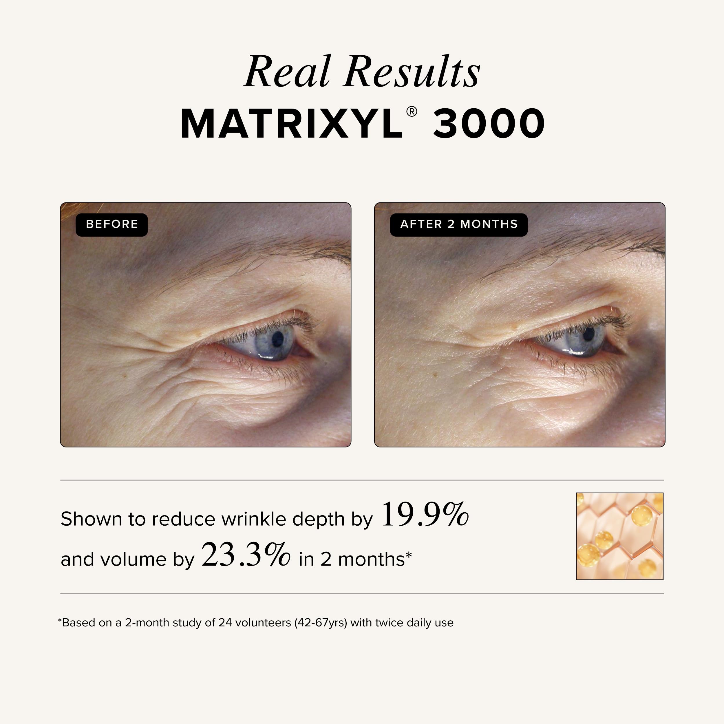 Asterwood Matrixyl 3000 + Argireline serum bottle with hyaluronic acid emphasis on hydration