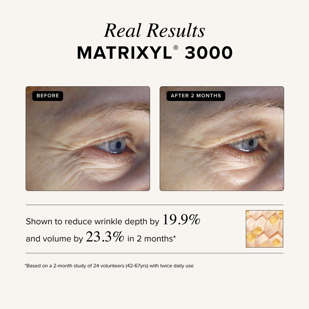 Asterwood Matrixyl 3000 + Argireline serum bottle with hyaluronic acid emphasis on hydration