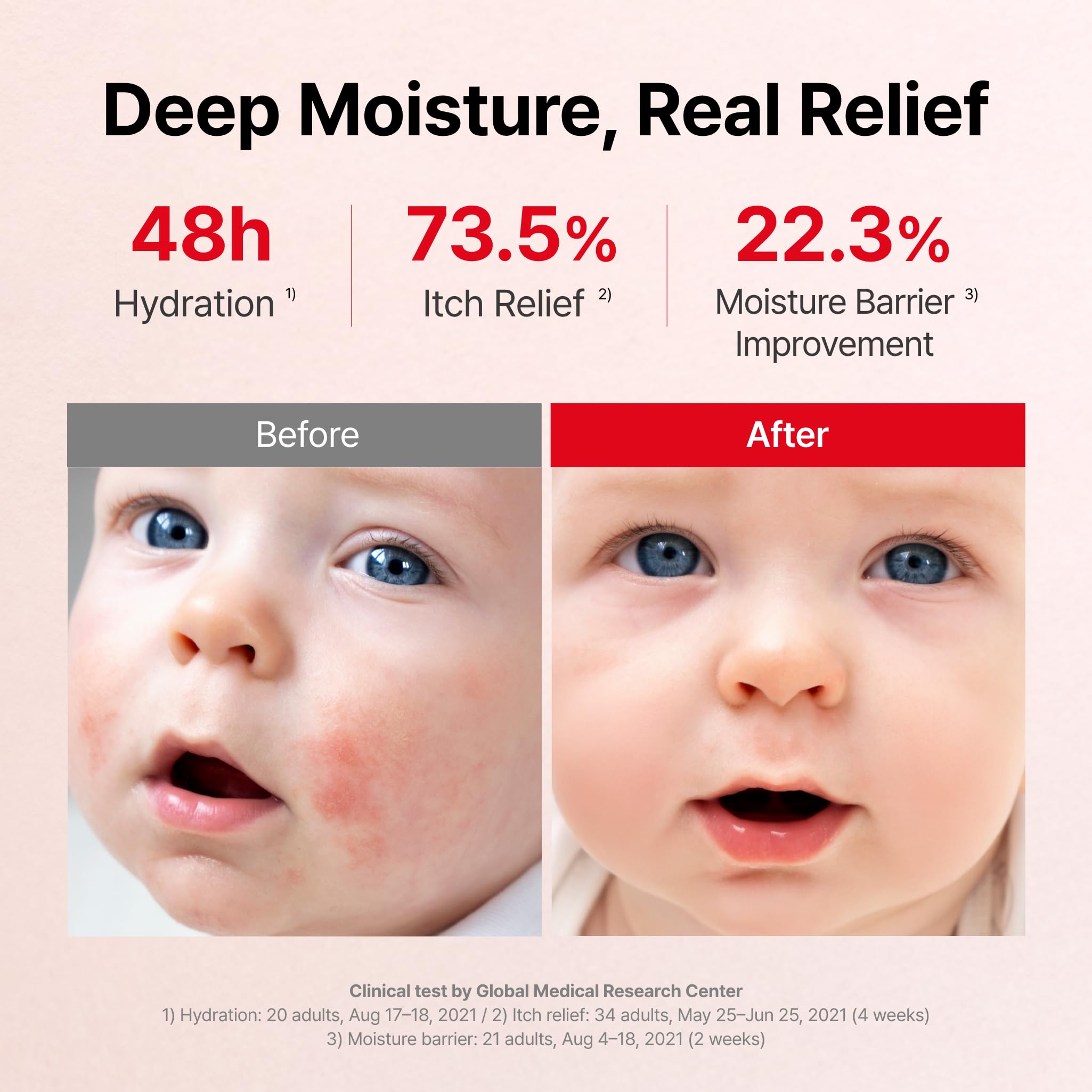 ATOPALM MLE eczema cream on forearm demonstrates long-lasting moisture for dry skin.