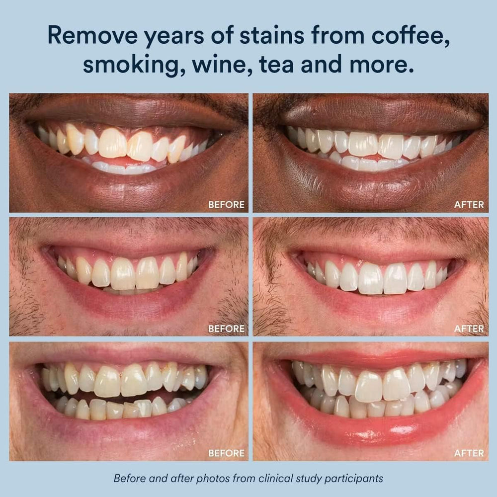Auraglow works with Invisalign trays and retainers for versatile whitening.