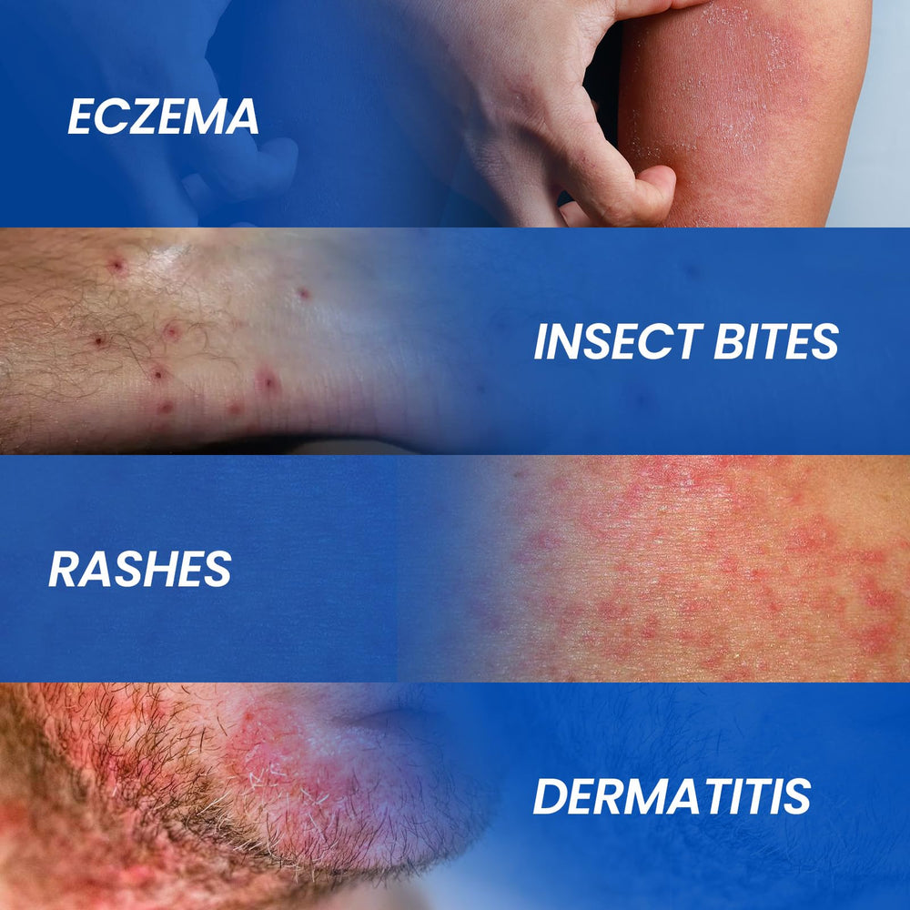 AVEDANA packaging displays ingredients and aloe for dermatitis care.