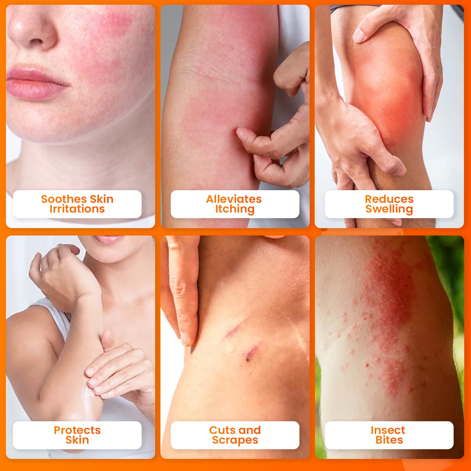 Applying AVEDANA ointment to affected skin for soothing relief