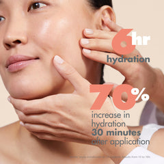 Skin after cleansing with Avène Gentle Milk Cleanser appears hydrated and comfortable.