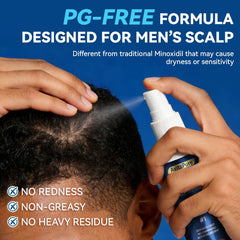 AVITAPURE fast-dry minoxidil spray showing non-greasy finish after application