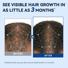 AVITAPURE active ingredients on label: biotin, rosemary, castor oil for scalp nourishment