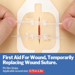 AZEN emergency wound closure device in use for secure protection.
