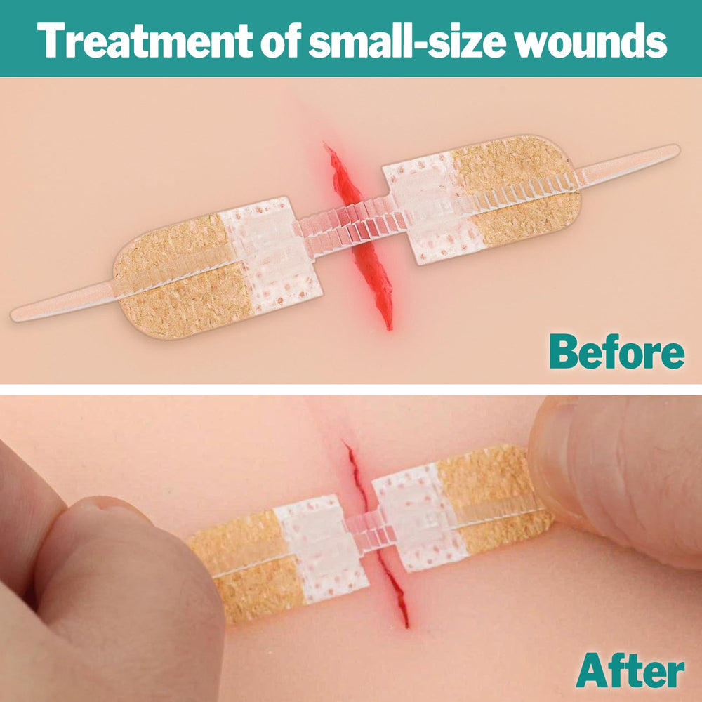 AZEN hypoallergenic bandage materials provide breathable, reliable adhesion during everyday activities.