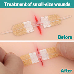 AZEN hypoallergenic bandage materials provide breathable, reliable adhesion during everyday activities.