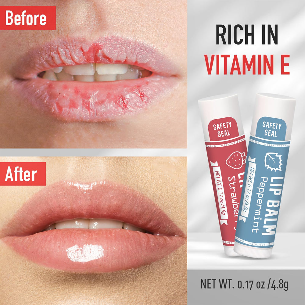 AZEN pineapple lip balm provides smooth lips and light fragrance