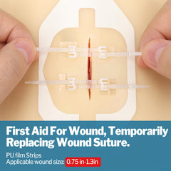 AZEN wound closure kit components neatly organized inside packaging.