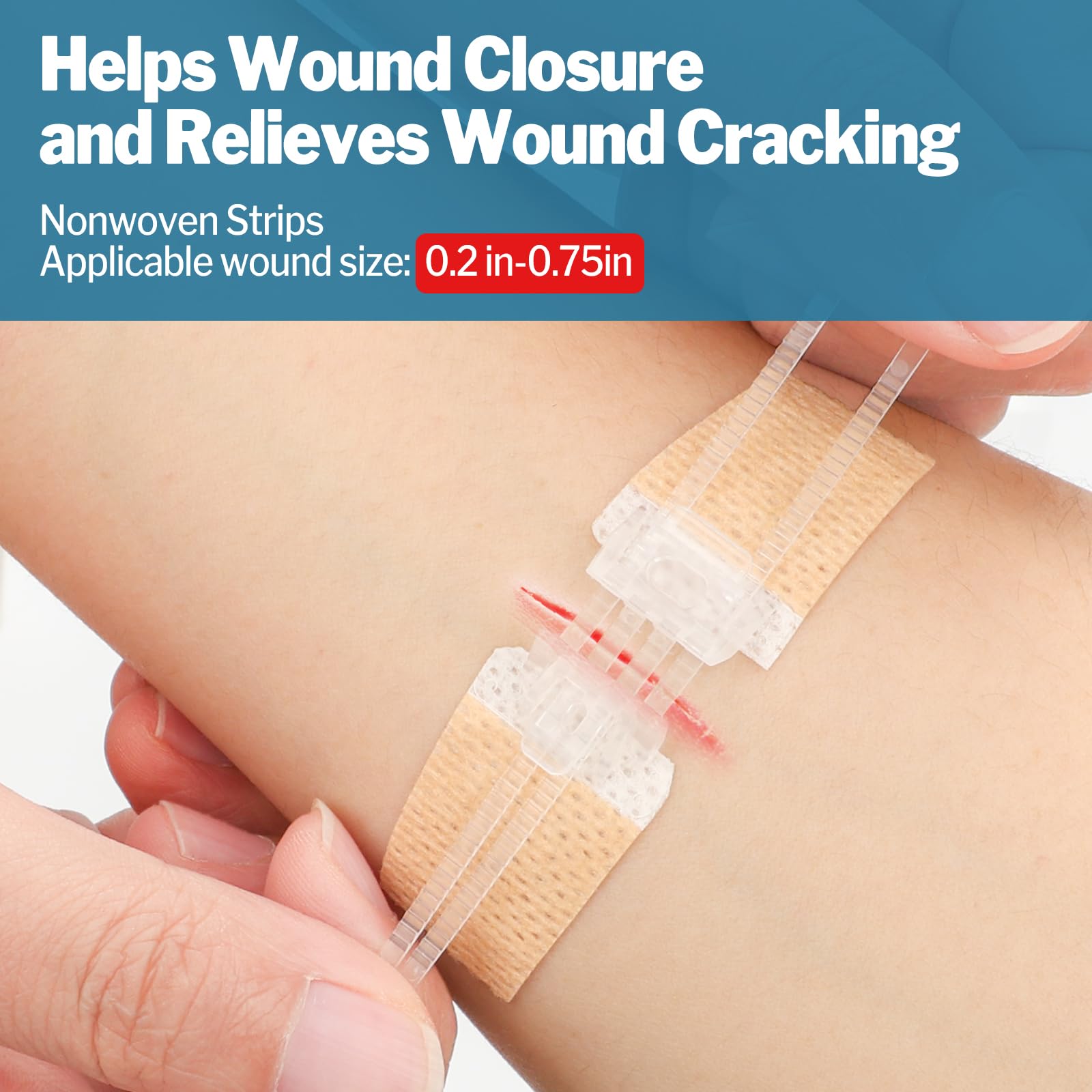 AZEN zip stitch wound closure device in use for fast closure.