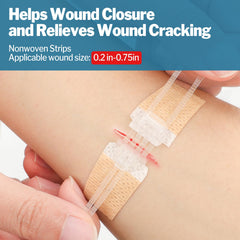 AZEN zip stitch wound closure device in use for fast closure.