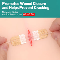 AZEN zip stitch wound closure demonstrates painless, secure closure for small cuts.
