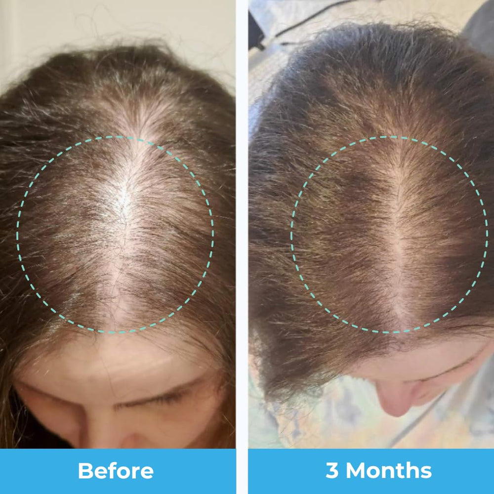 Baby Blues biotin, collagen, zinc, folate ingredients list on packaging