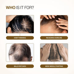 Bare Anatomy Advanced Hair Density Roll-On cap on a sleek bottle for travel-friendly care