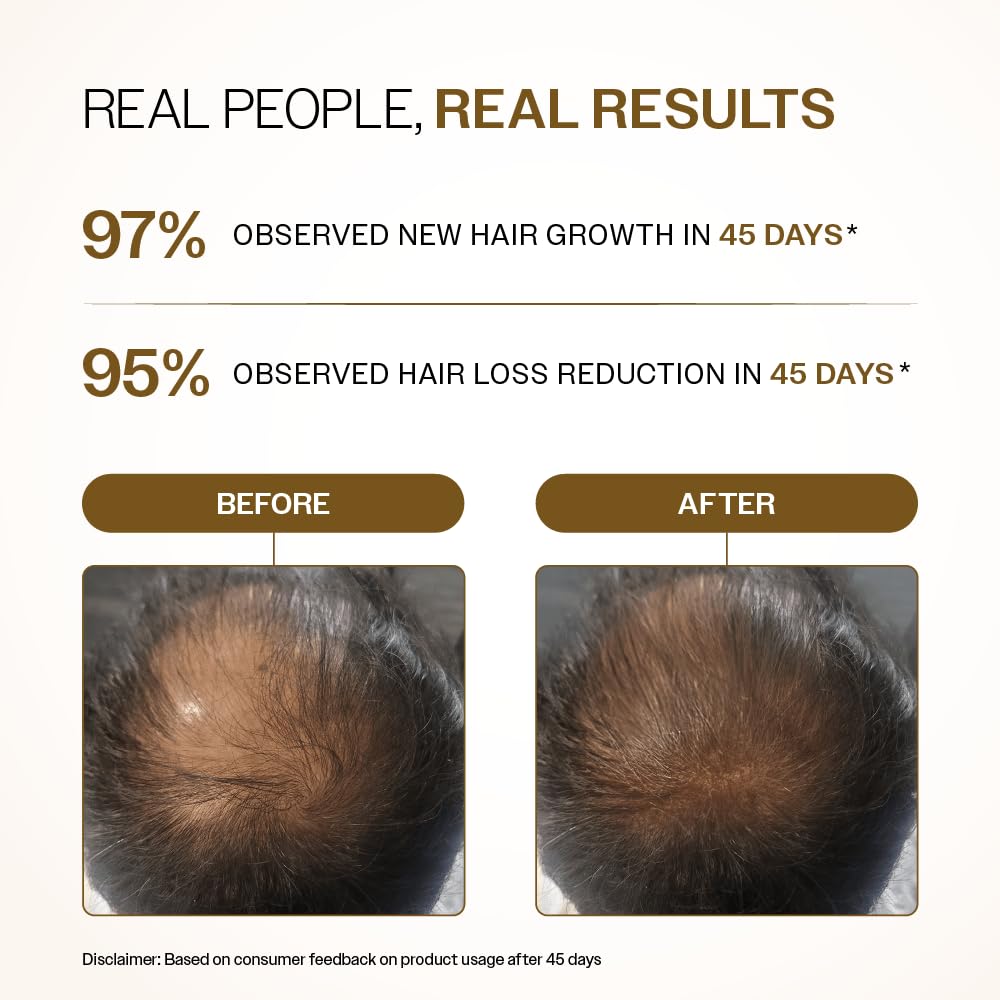 Bare Anatomy Advanced Hair Density Roll-On label emphasizes actives for hair health
