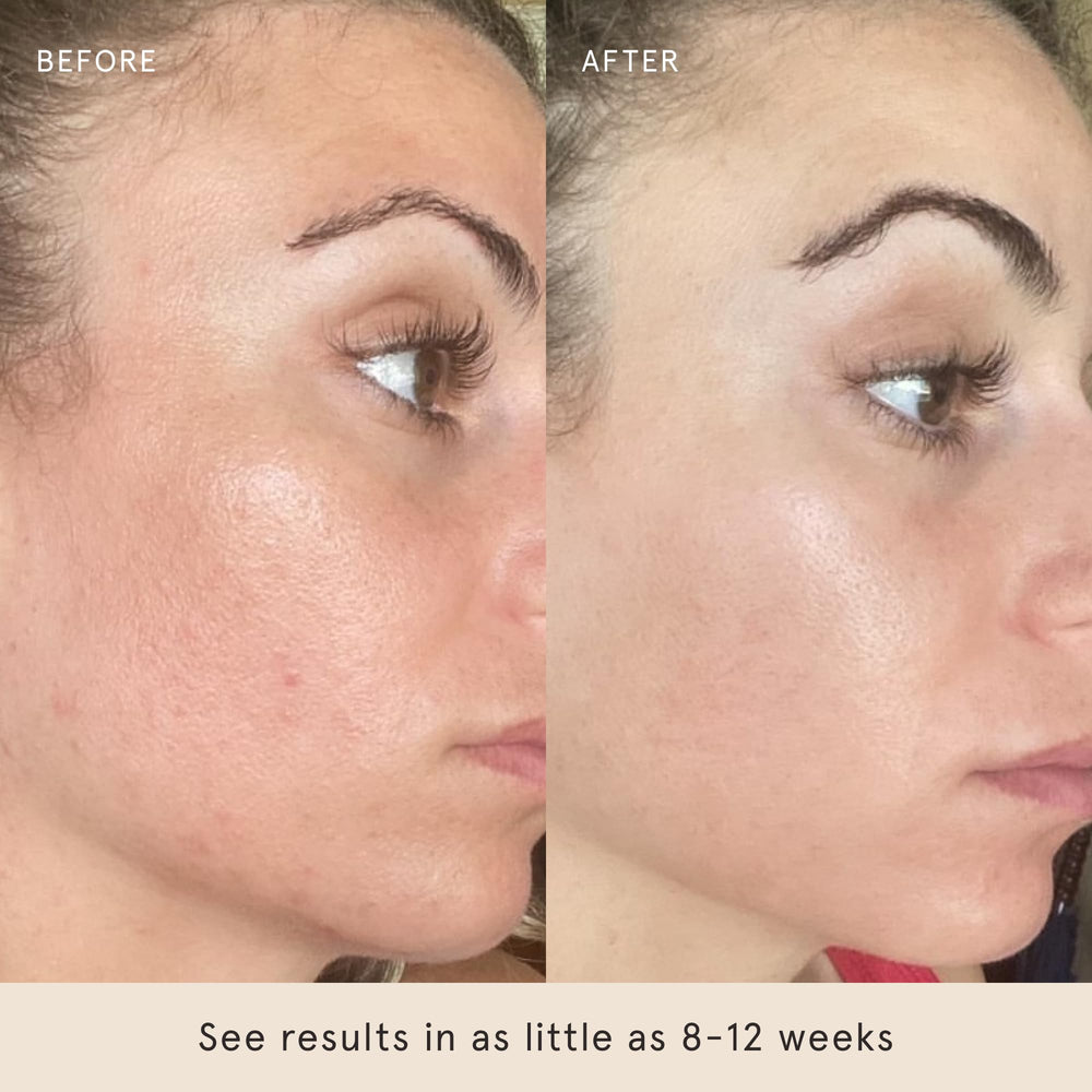 Barefaced Toning Pads after-use glow suggesting brightness.