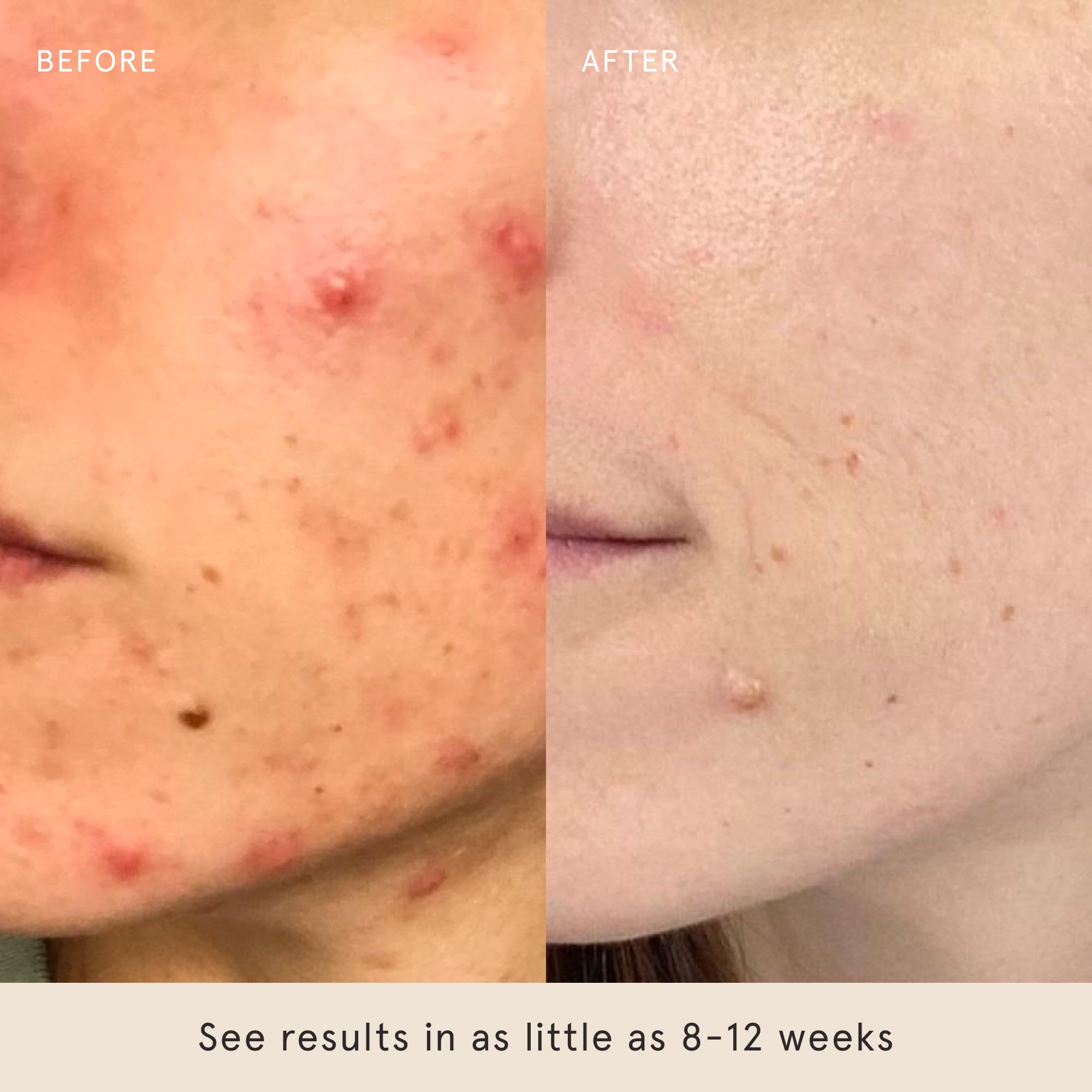 Barefaced Toning Pads II routine setup hints at a three-times-weekly schedule