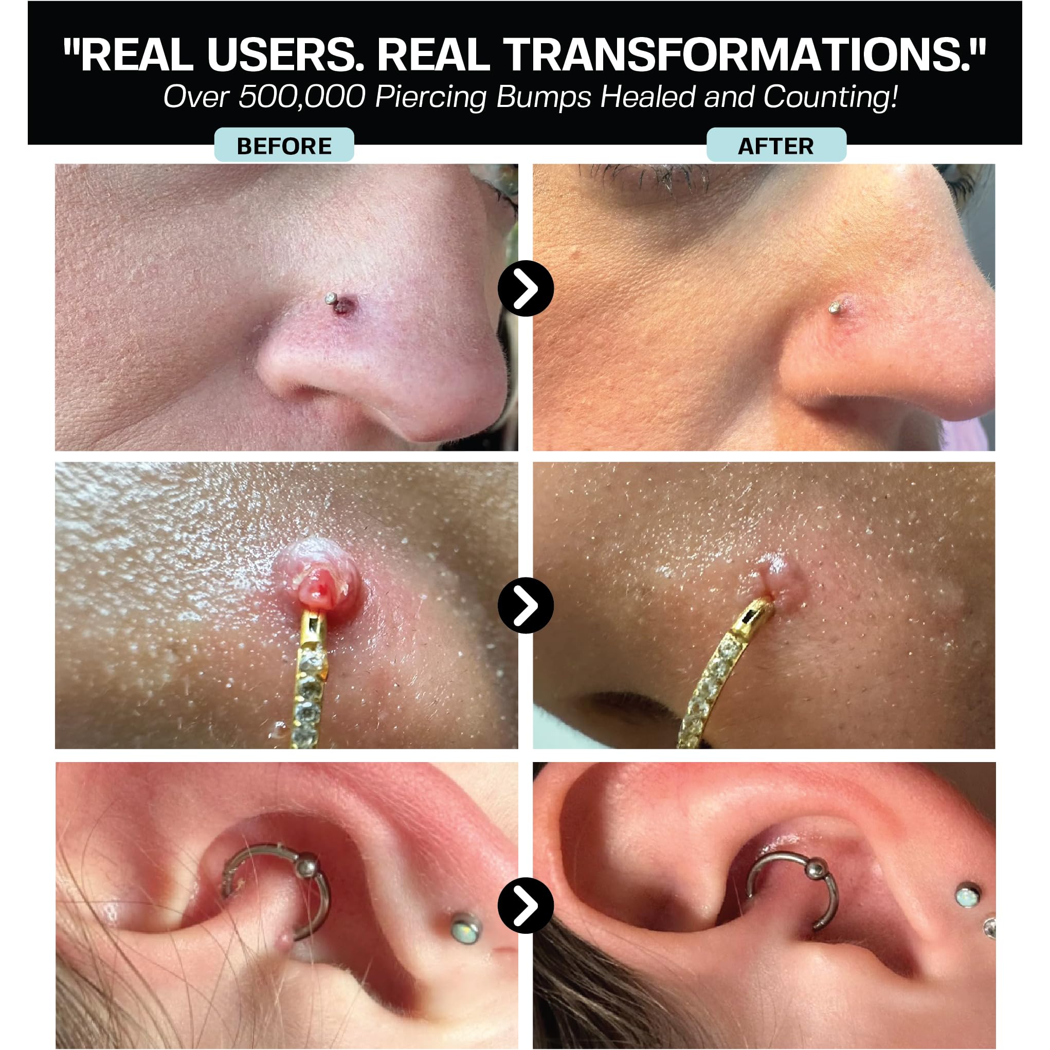 BASE LABORATORIES nose piercing care spray for irritation relief