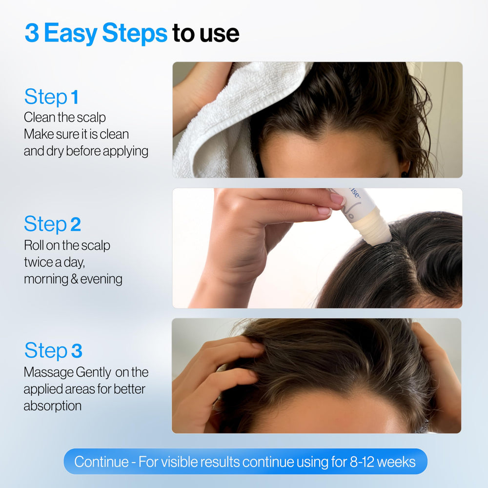 Be Bodywise Advanced Hair Density Roll-On Serum before-after example.