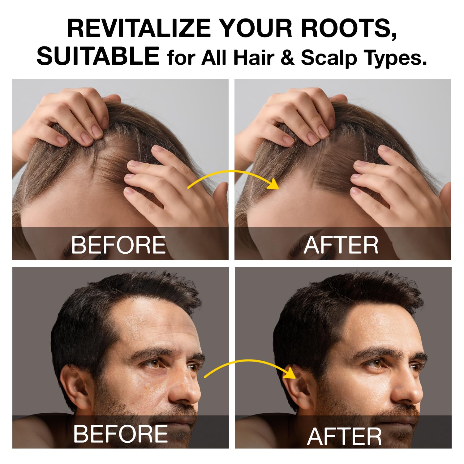 Beadlamey Root Activator Shampoo hands application for daily routine