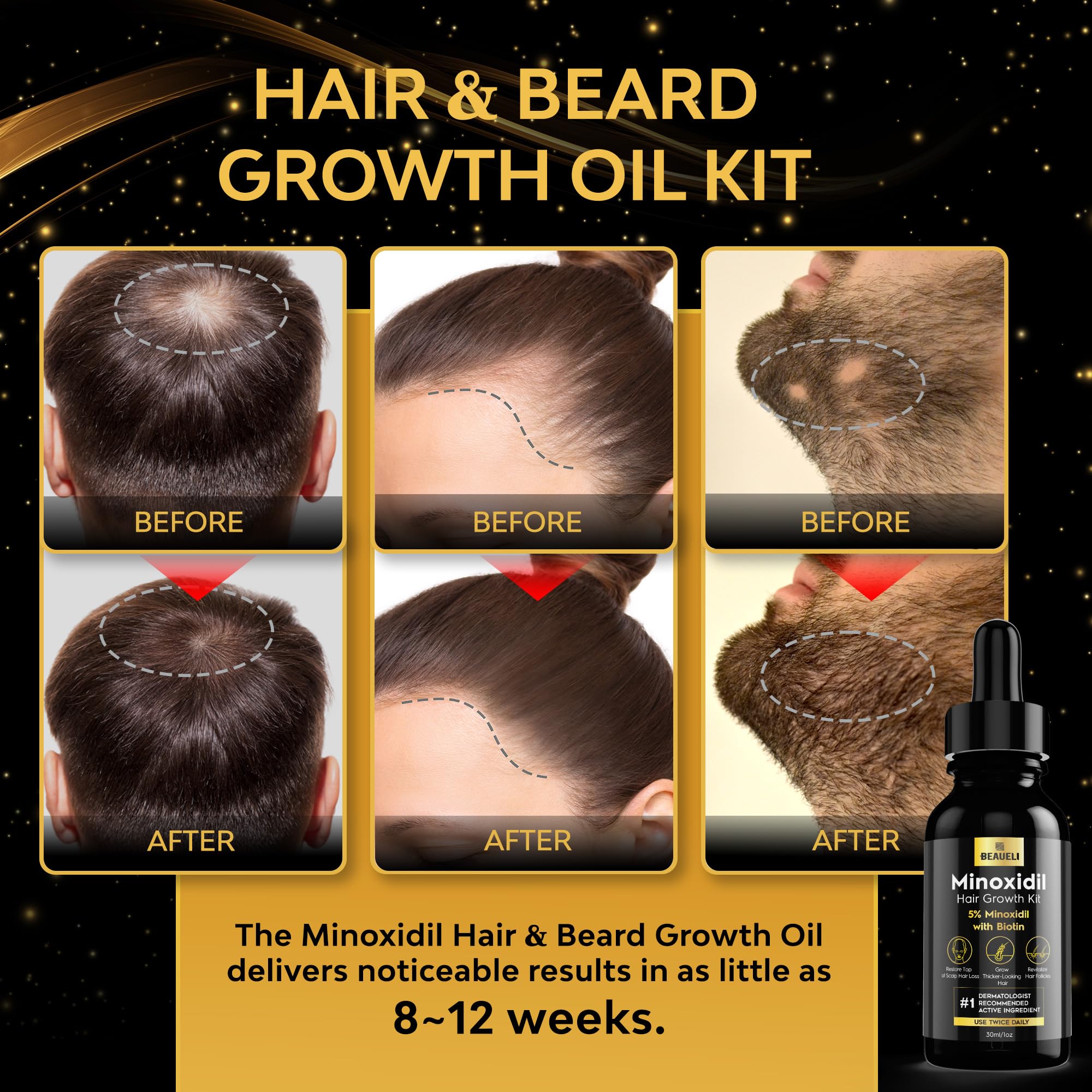 Beaueli minoxidil 5percent serum drops for daily scalp and beard use.