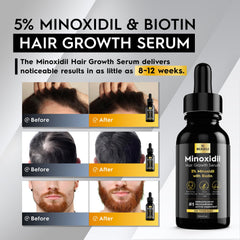 Beaueli Minoxidil application dropper for precise treatment.