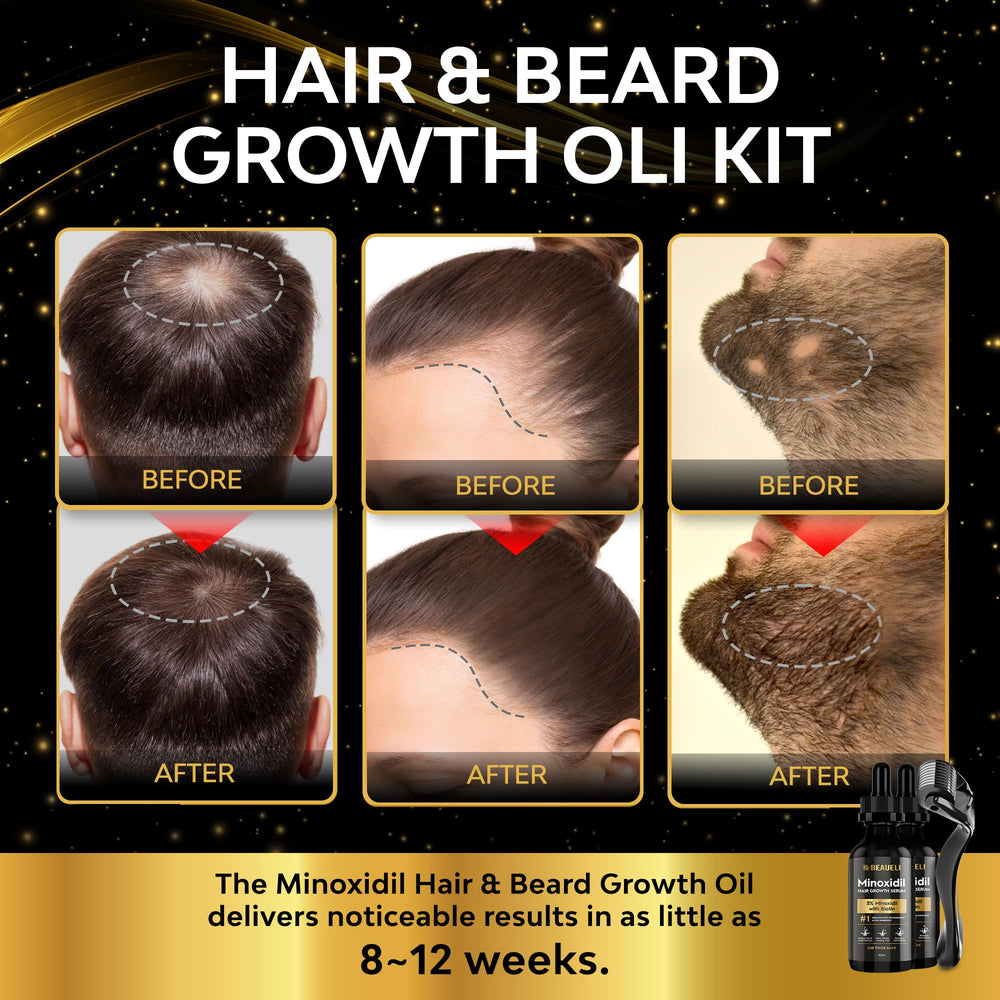 Beaueli minoxidil serum dropper demonstrates precise application for targeted thinning areas