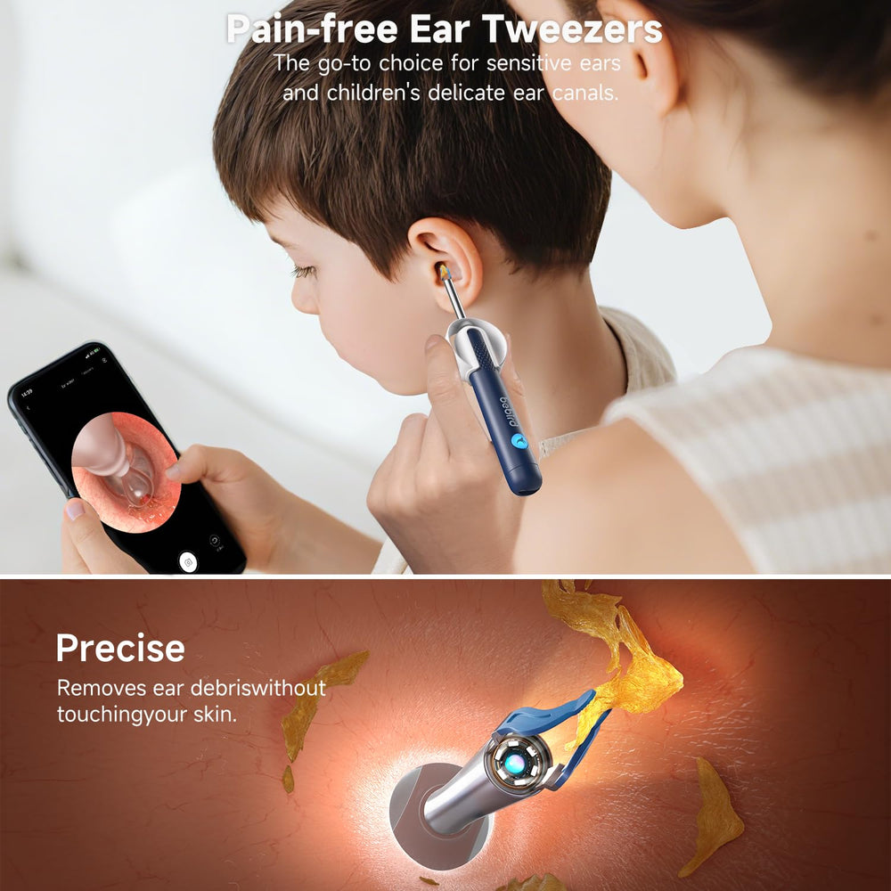 BEBIRD R1 Ultra gentle ear tweezers protect delicate ear walls.