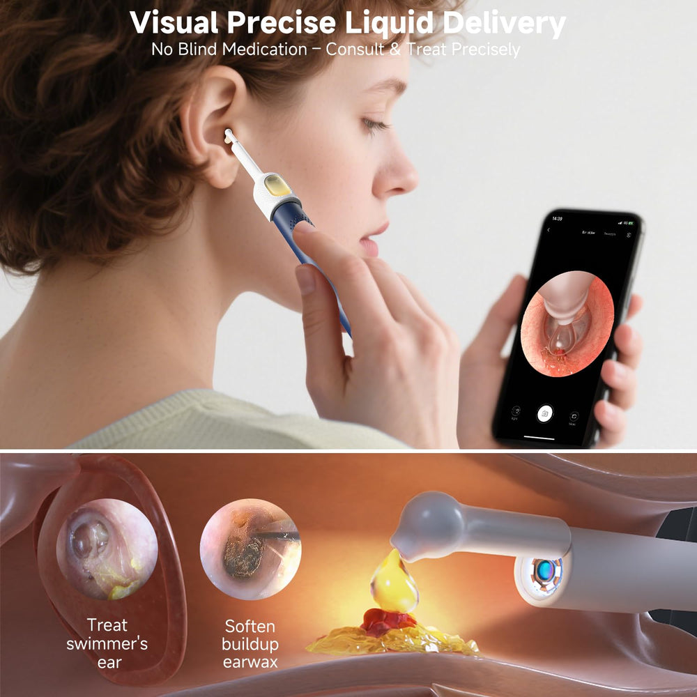 BEBIRD R1 Ultra visible ear dropper enables precise treatment.