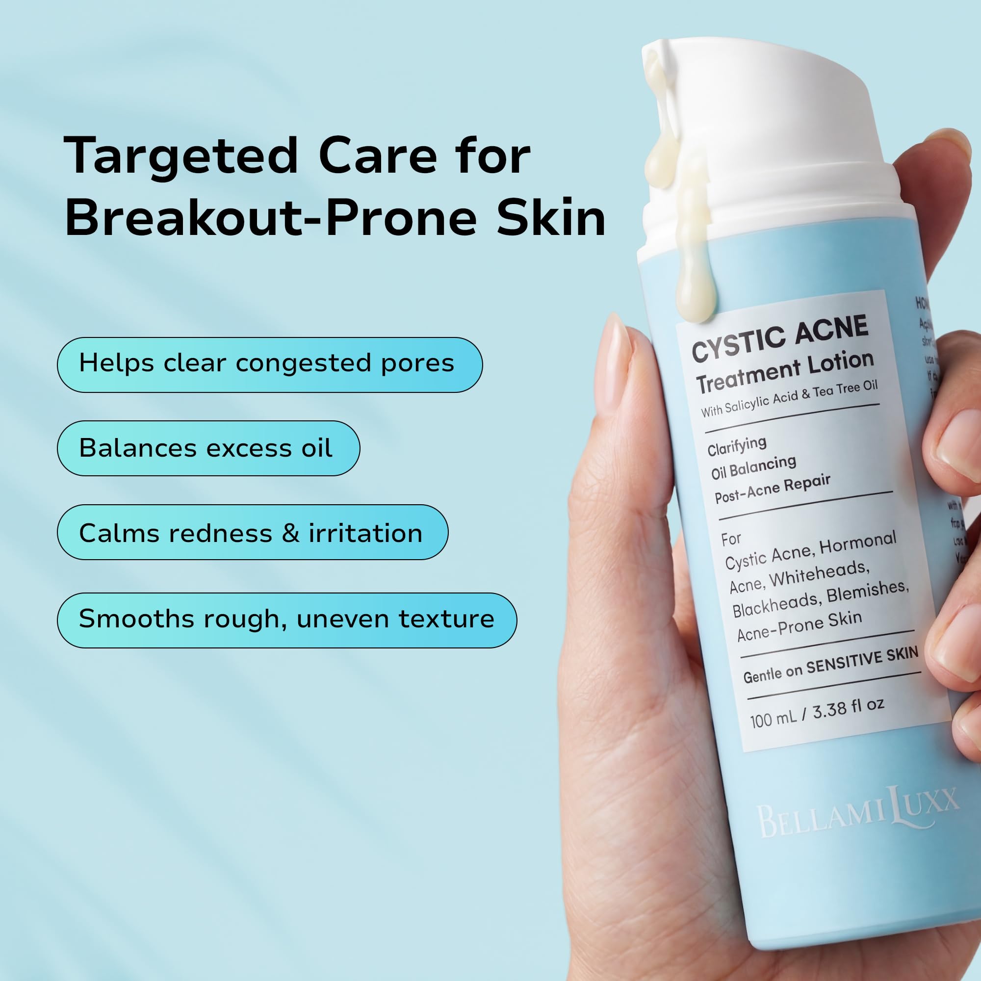 BellamiLuxx cystic acne lotion texture closeup shows lightweight, fast-absorbing formula.
