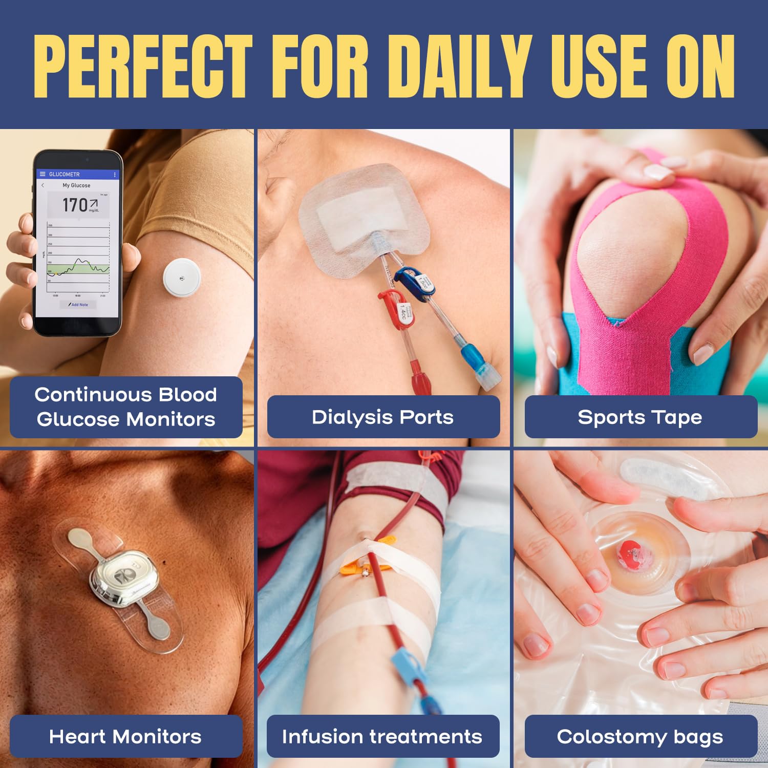 Berkland Sting-Free Adhesive Remover for colostomy bag adhesive care.