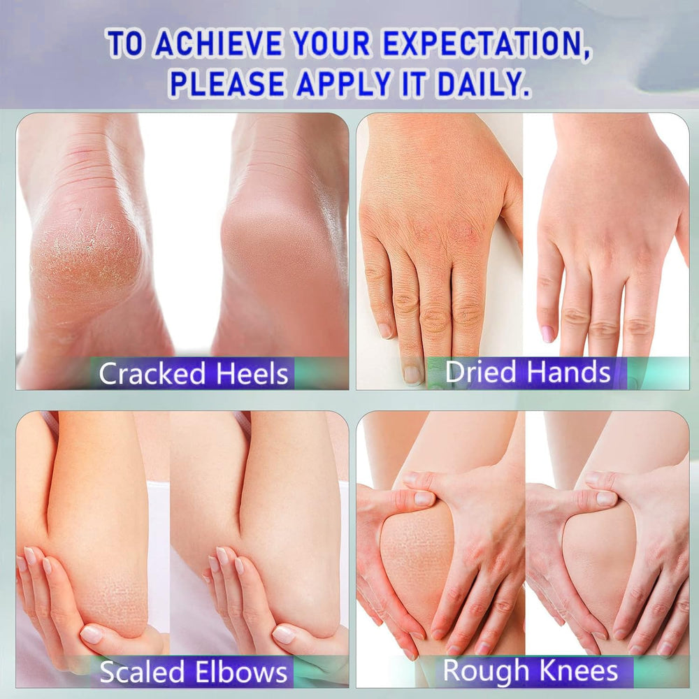 Ingredients like avocado and glycerin in BERVEAL Urea Cream nourish the skin