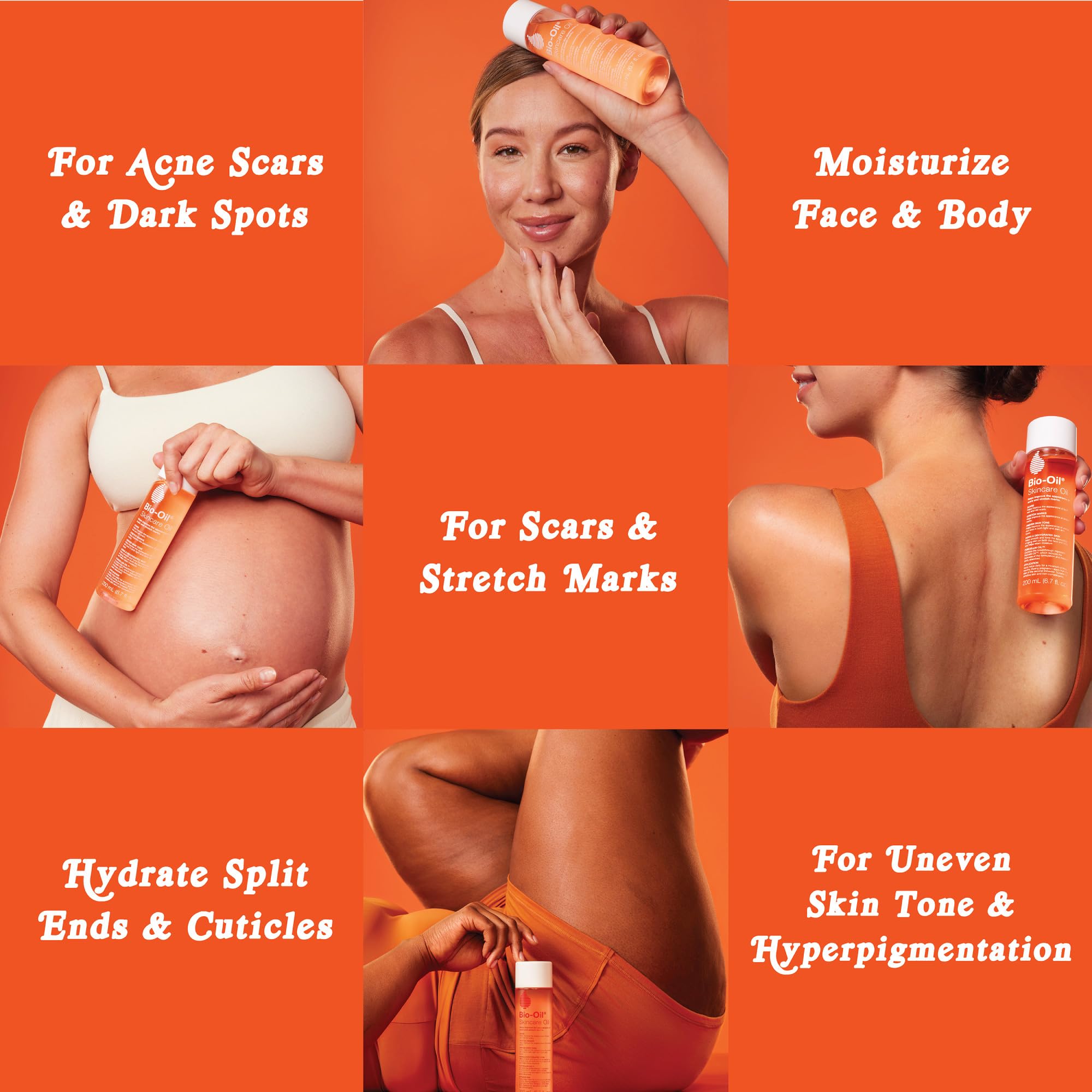 Bio-Oil on dry skin provides lasting moisture without clogging pores.