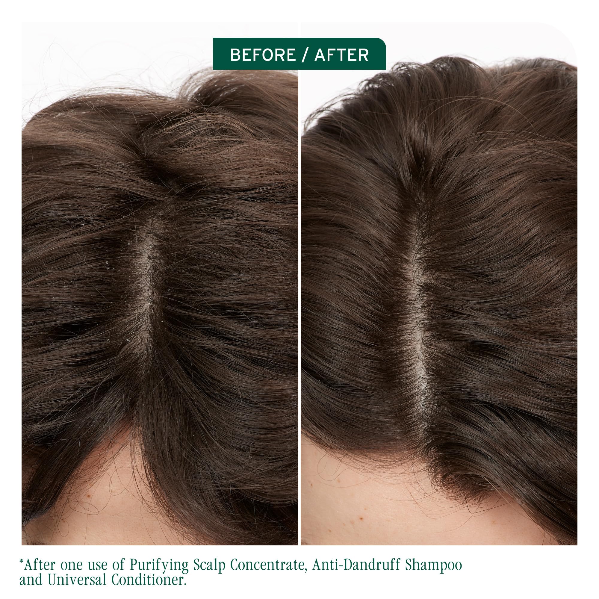 Biolage Scalp Sync provides a rich lather for thorough cleansing.