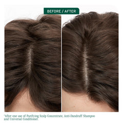 Biolage Scalp Sync provides a rich lather for thorough cleansing.