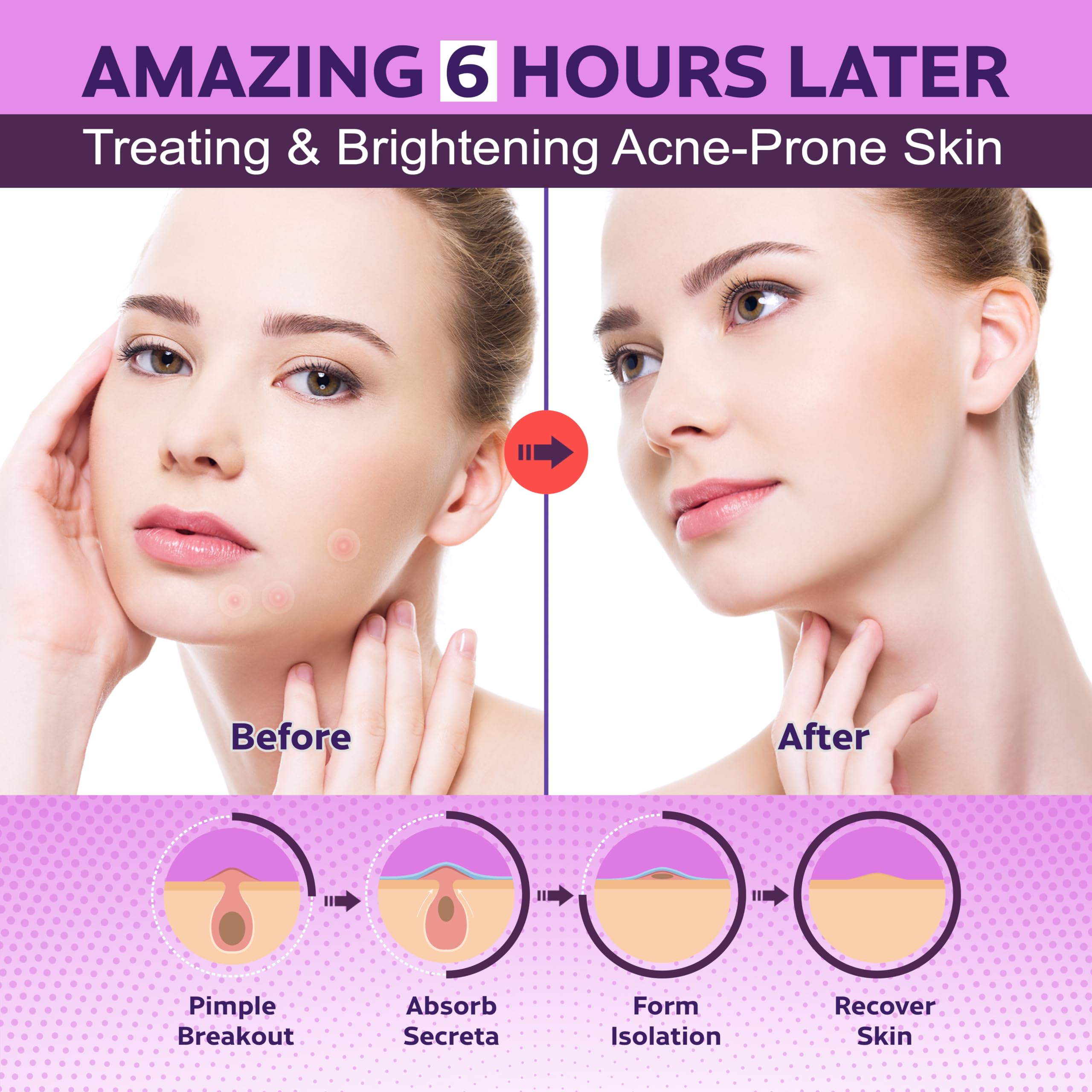 BIO'LEARY all-in-one acne care image shows consolidated fix for multiple concerns